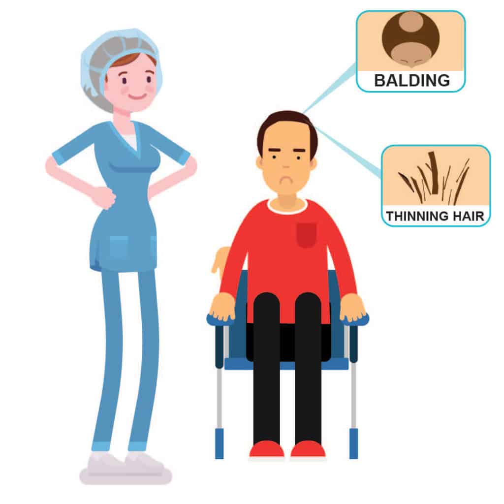 illustration showing hair loss